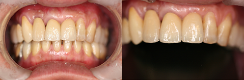 case1_after.png